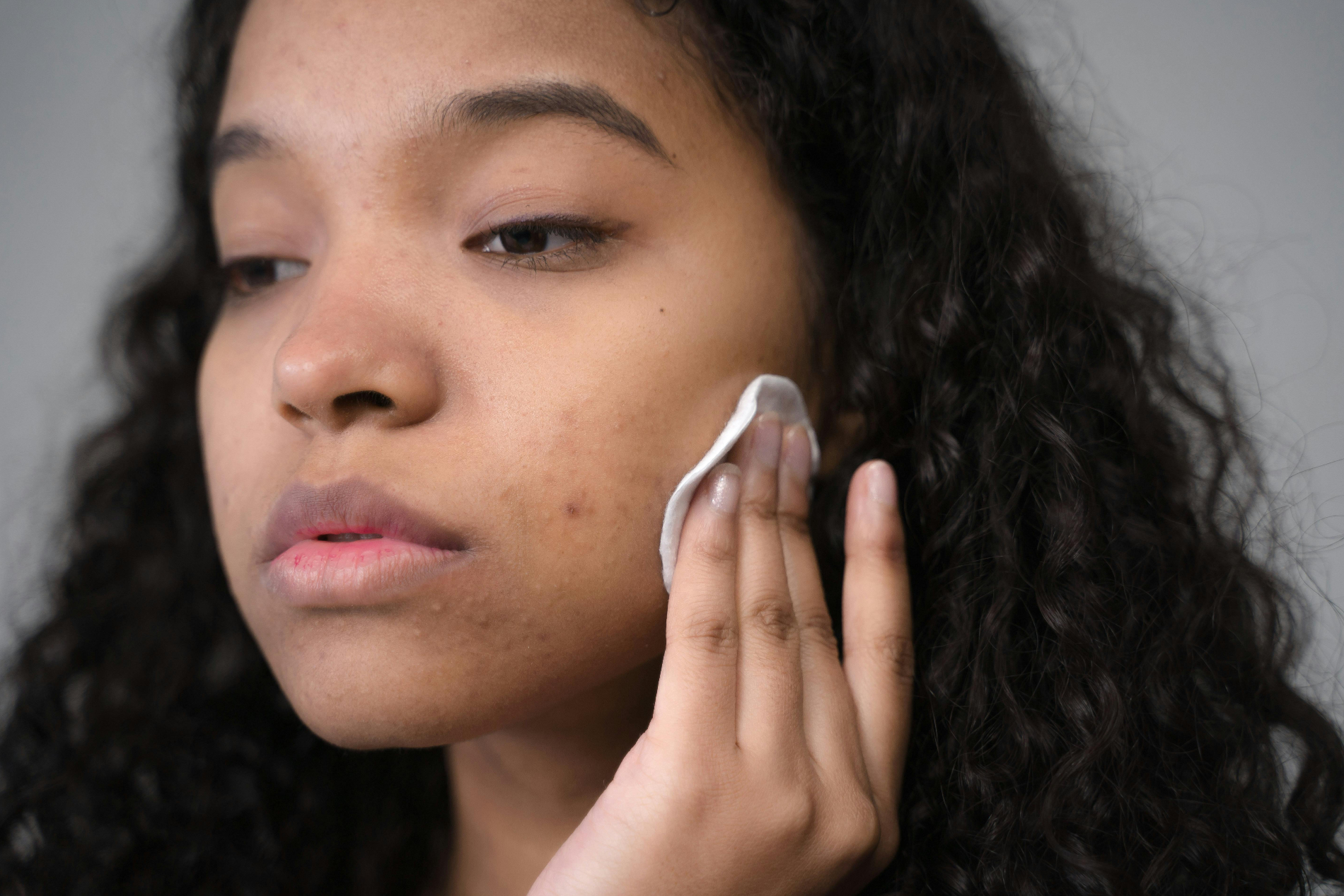 mixed race girl with long wavy hair holding cotton pad to her face